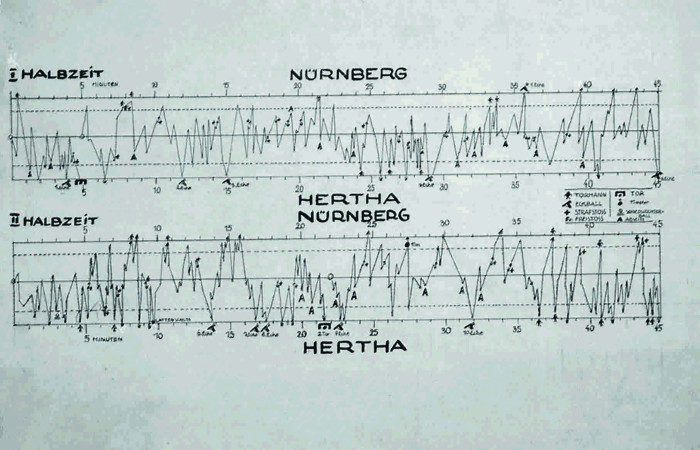 EKG_Jacoby